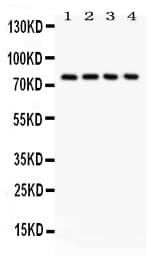 Polyclonal Rabbit anti-Human MAPT / Tau Antibody (aa29-44, WB)