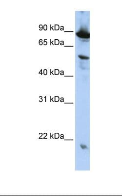 Polyclonal Rabbit anti-Human ZGPAT Antibody (N-Terminus, IHC, WB)
