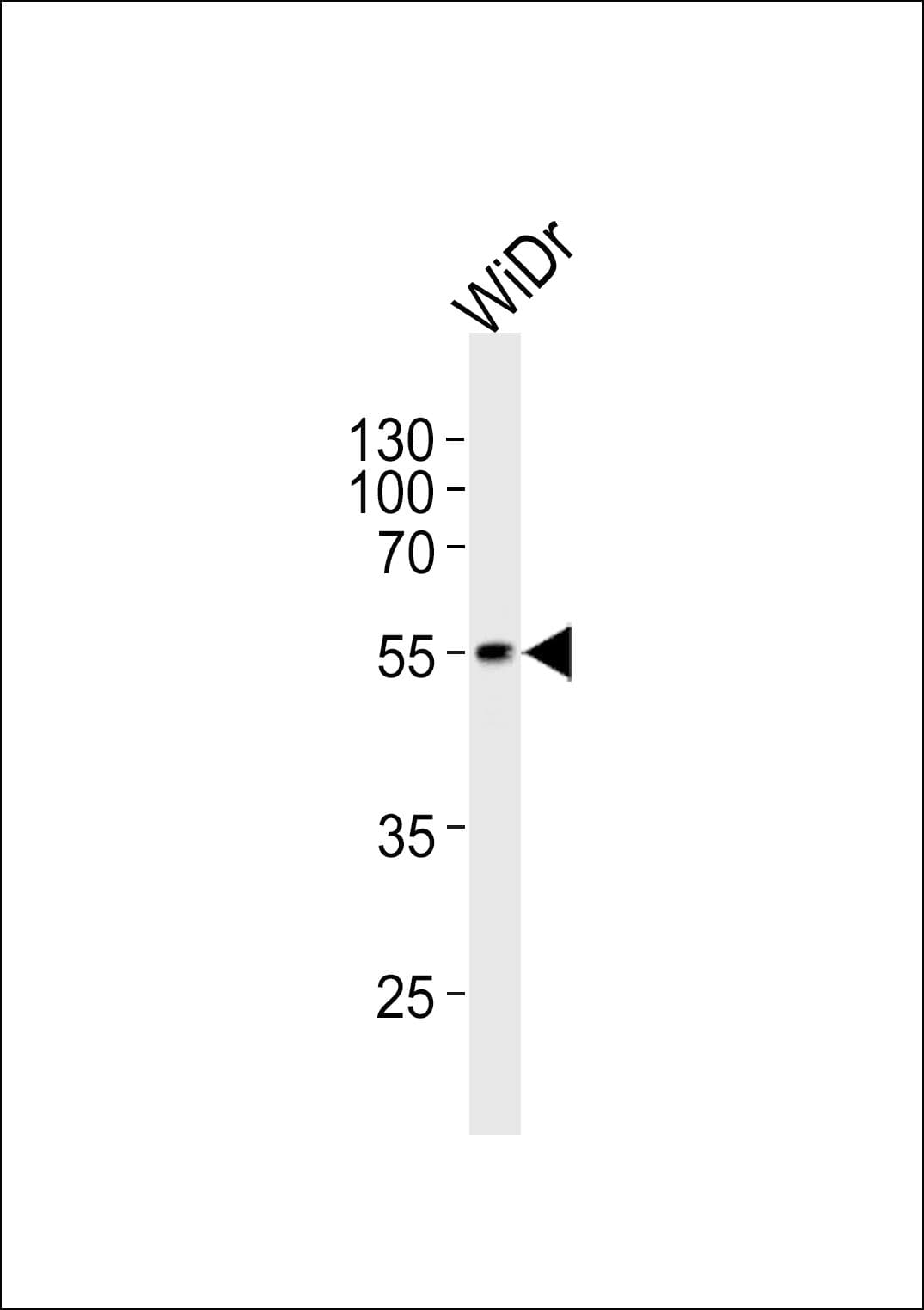 Polyclonal Rabbit anti-Human PDHX / Protein X / ProX Antibody (aa429-459, IHC, WB)