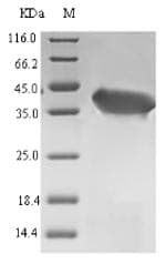 Laribacter hongkongensis OPRT Protein (Recombinant 6His-SUMO, N-terminus)
