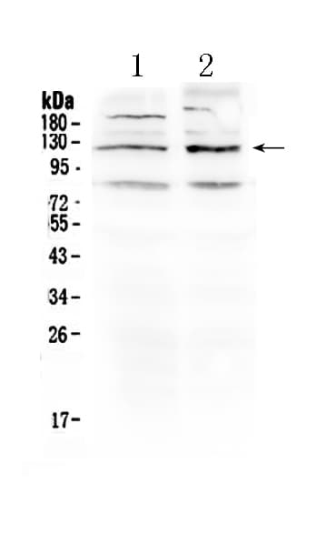GABBR1 / GABA B Receptor 1 Antibody