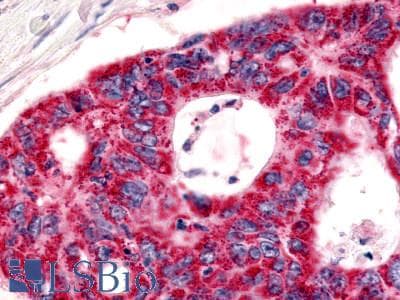 PathPlus™ BOB / GPR15 Antibody (Cytoplasmic Domain)