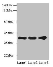 Polyclonal Rabbit anti-Human FAM82B Antibody (IHC, WB)