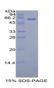 Human ADIPOR1/Adiponectin Receptor 1 Protein (Recombinant His-MBP)