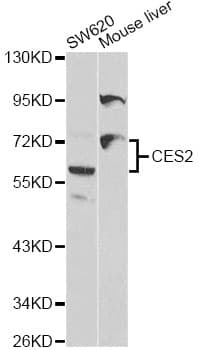 CES2 / Esterase Antibody