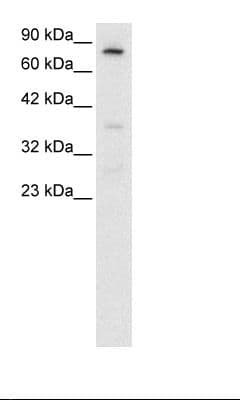 Polyclonal Rabbit anti-Human FOXE3 Antibody (aa235-284, IHC, WB)