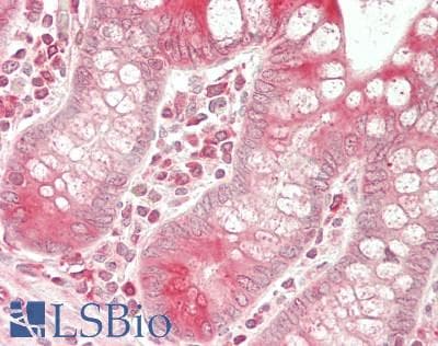 IHC-plus™ BCAP31 / BAP31 Antibody (aa 2-234)