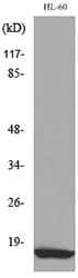 Polyclonal Rabbit anti-Human CCL4 / MIP-1 Beta Antibody (WB)