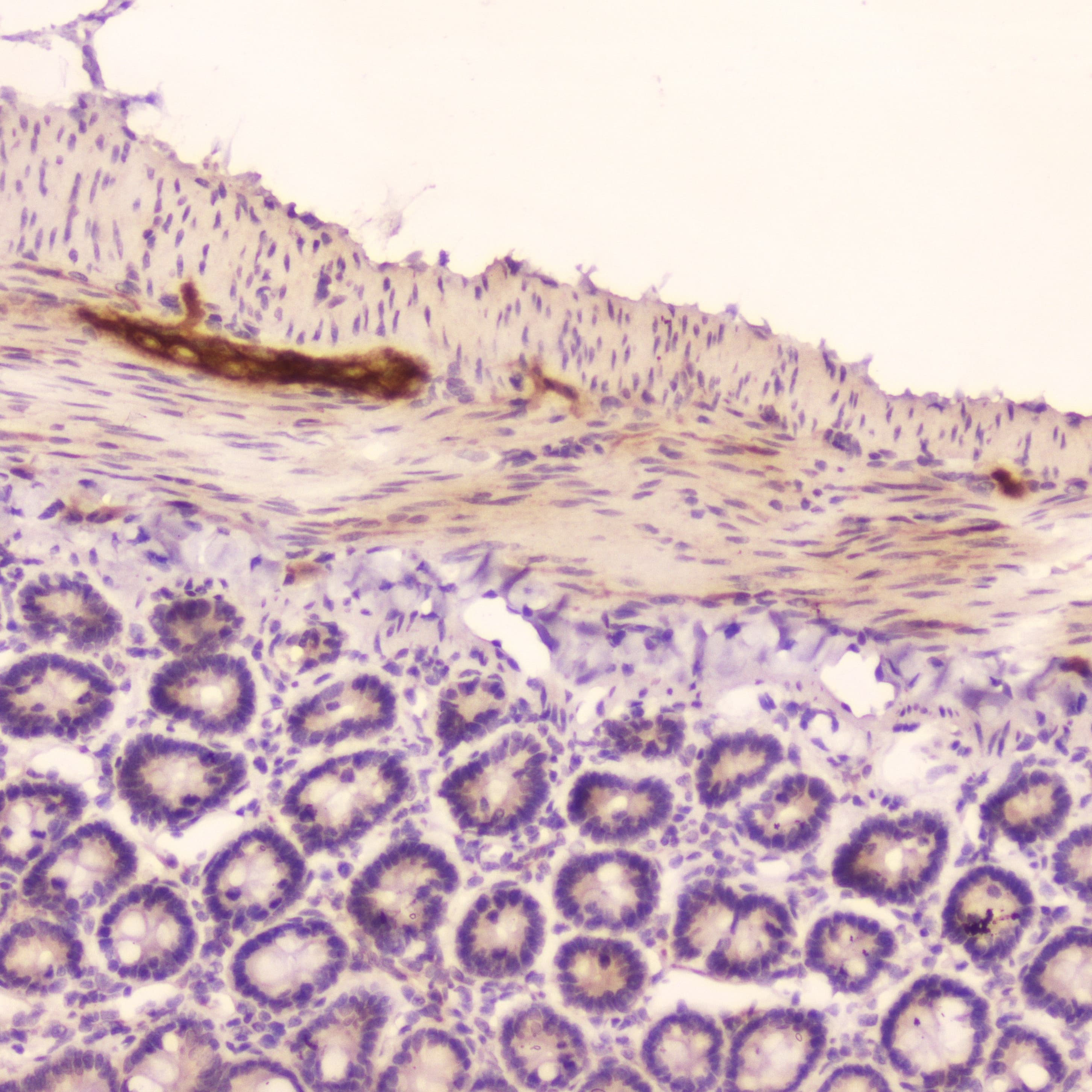 NPPA / ANP Antibody