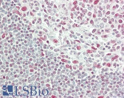IHC-plus™ XRN2 Antibody (aa25-75)