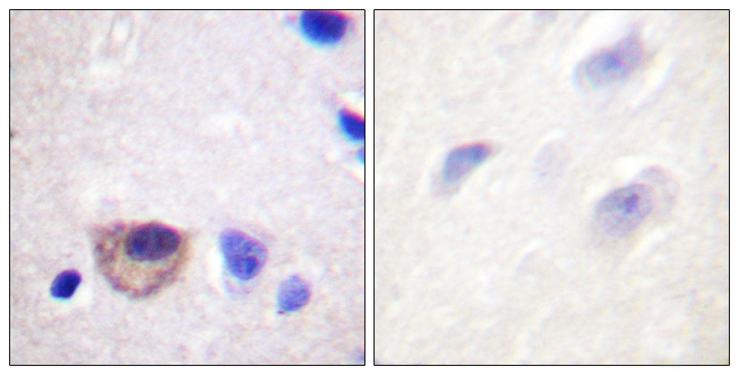 ATP1A1 Antibody (p16)