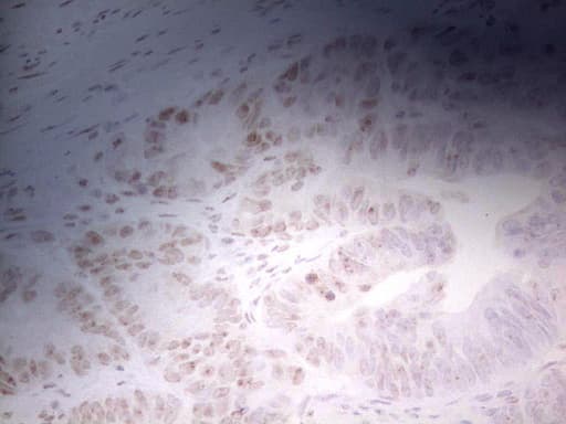 Monoclonal Mouse anti-Human ERCC1 Antibody (clone OTI6H7, Carrier-free, IHC, WB)
