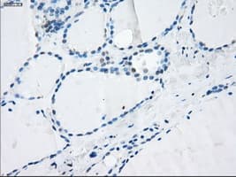LTA4H / LTA4 Antibody (clone OTI2A9)
