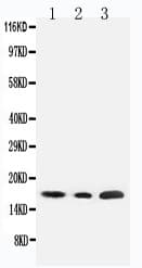 SDHC Antibody (aa35-50)