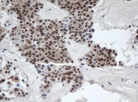 Alpha4GnT / A4GNT Antibody (clone OTI5B5)