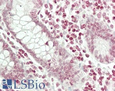 IHC-plus™ Polyclonal Rabbit anti-Human RASSF2 Antibody (aa93-142, IHC, WB)