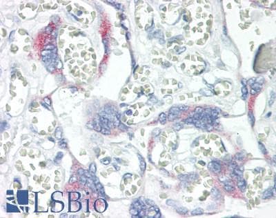 Monoclonal Mouse anti-Human KISS1 / Kisspeptin / Metastin Antibody (IHC, WB)