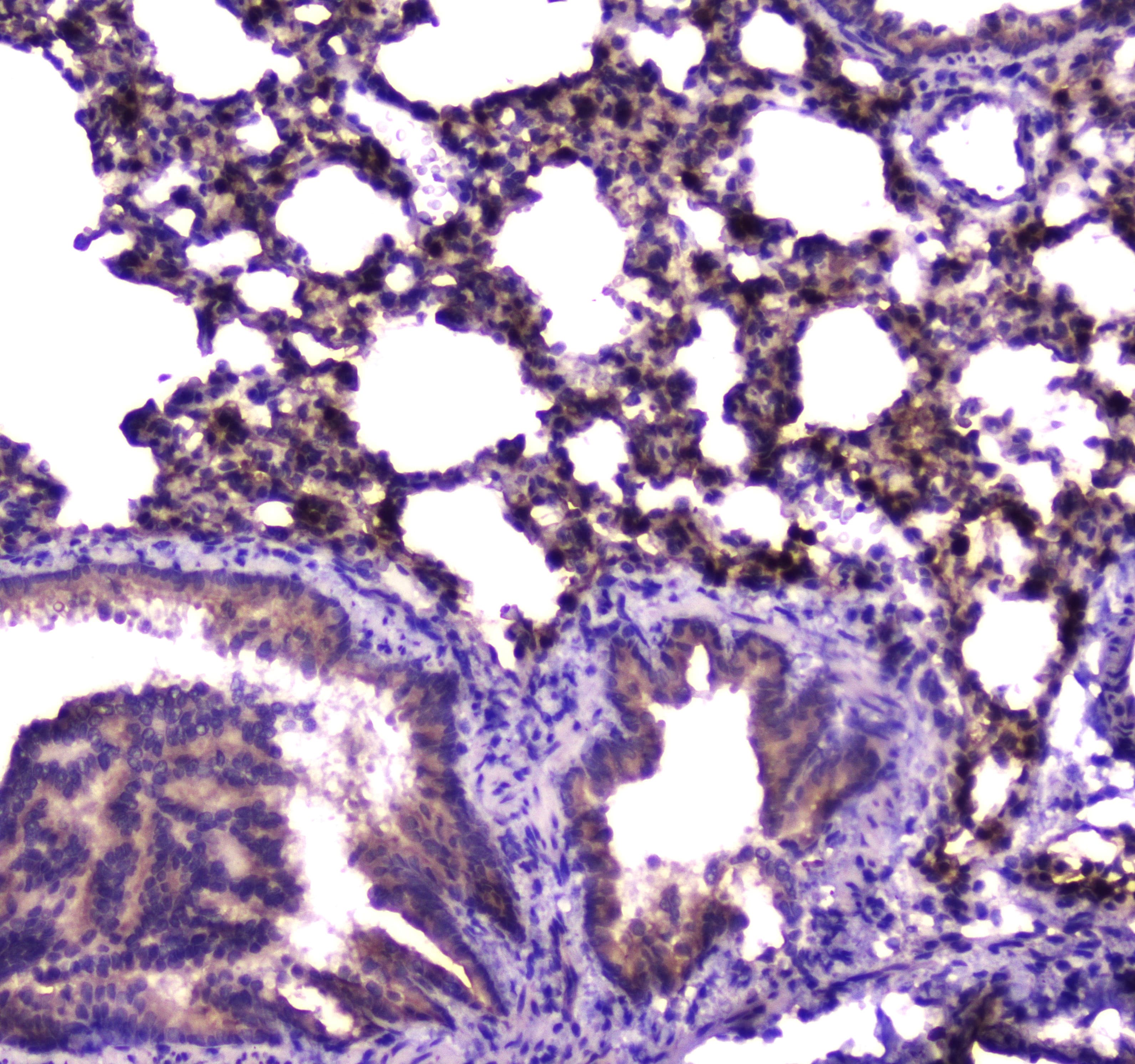E-FABP / FABP5 Antibody