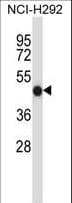 CD32A Antibody (aa256-285)
