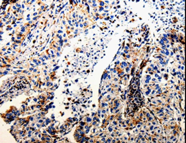 CTSZ / Cathepsin Z Antibody