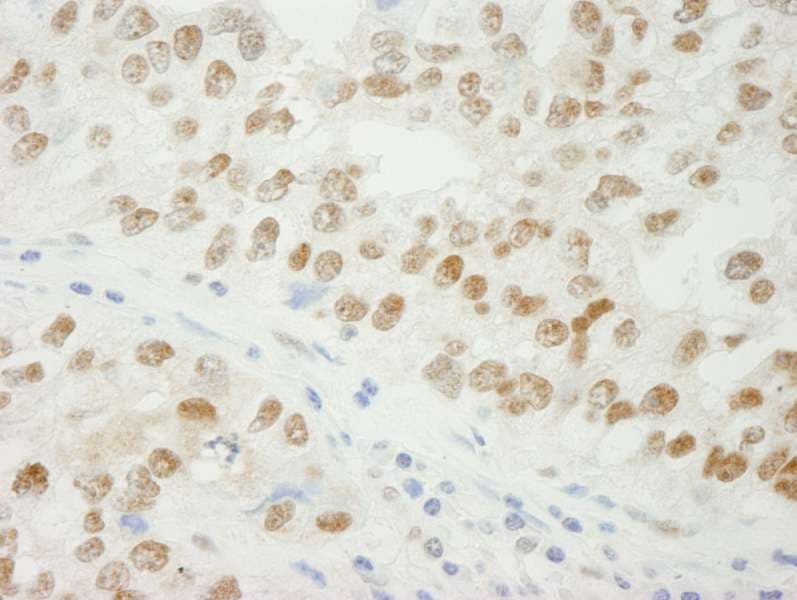 ADNP Antibody (aa1050-C-term)