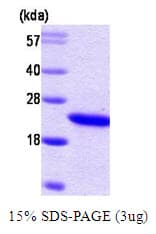 Human RBP4 Protein (Recombinant)