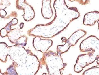 PLAP / Alkaline Phosphatase Antibody (clone ALPP/870)