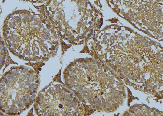 Polyclonal Rabbit anti-Human DNAJB11 Antibody (IHC, IF, WB)