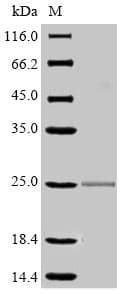 Mouse FCGR3 Protein (Recombinant 6His, N-terminus)