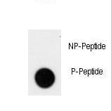 TNK2 / ACK1 Antibody (phospho-Tyr826)