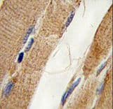 IHC-plus™ PIK3C3 / VPS34 Antibody (Ser425)
