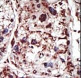 Syndapin I / PACSIN1 Antibody (aa8-38)