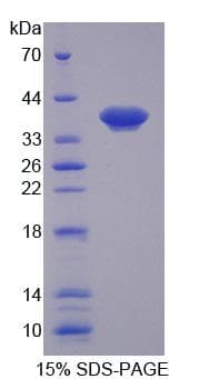 Human SLC25A39 Protein (Recombinant His, N-Terminal)