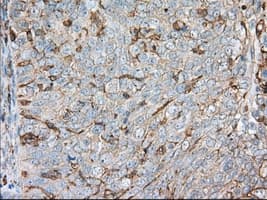 Monoclonal Mouse anti-Human ALDH3A1 Antibody (clone OTI1C6, IHC, IF, WB)