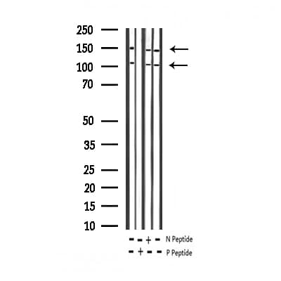 IGF1R / IGF1 Receptor Antibody (phospho-Tyr1346)