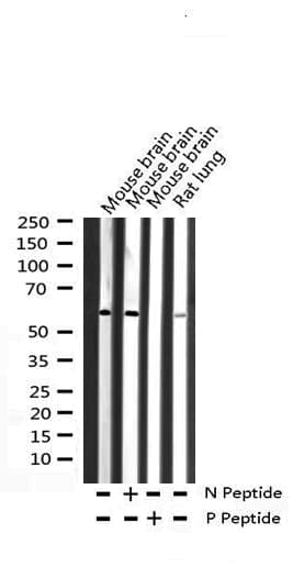 SMAD1 Antibody (phospho-Ser465)