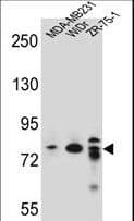 Polyclonal Rabbit anti-Human ARHGAP22 / RhoGAP2 Antibody (aa604-633, WB)