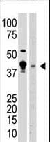 MBD2 Antibody (aa120-151)
