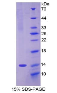Rat OLFM4 / Olfactomedin 4 Protein (Recombinant His)