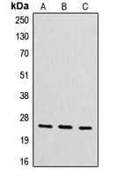 Polyclonal Rabbit anti-Human CYB561D2 Antibody (Internal, WB)