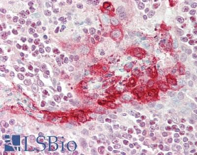 IHC-plus™ Polyclonal Rabbit anti-Human FLCN / Folliculin Antibody (aa1-50, IHC, WB)