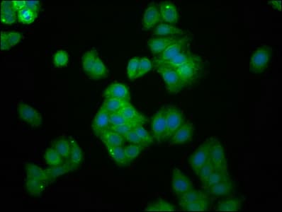 Polyclonal Rabbit anti-Human UBE2G1 Antibody (IHC, IF)
