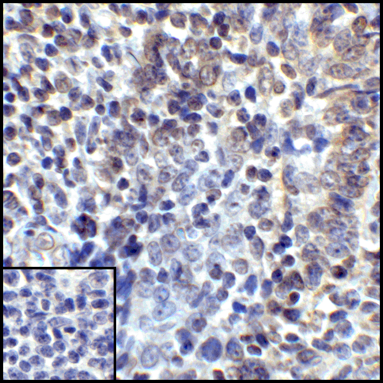 Monoclonal Mouse anti-Human CD274 / B7-H1 / PD-L1 Antibody (clone 4F2, IHC, IF, WB)