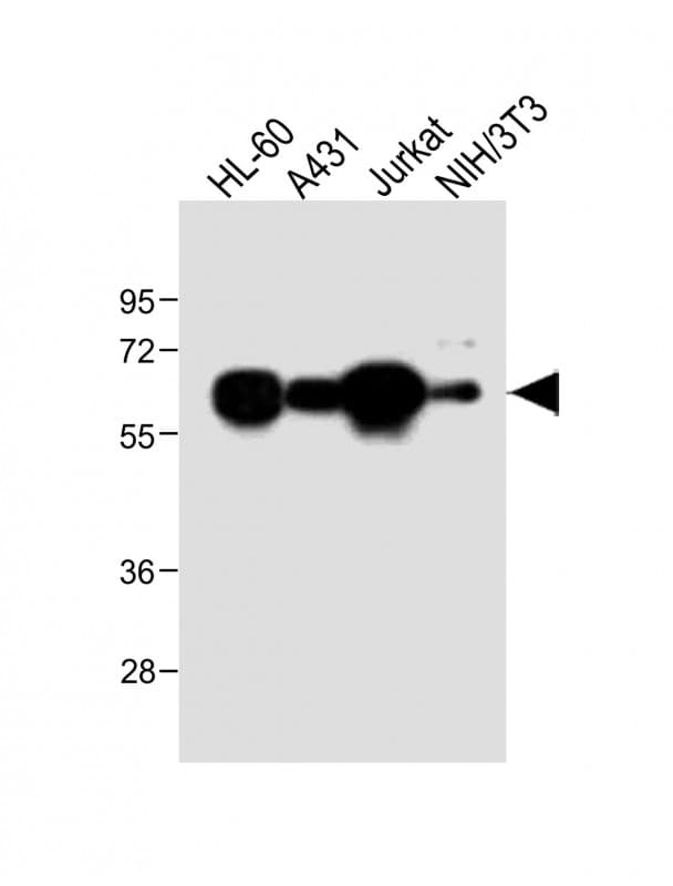 Polyclonal Rabbit anti-Human METTL14 Antibody (N-Terminus, WB)