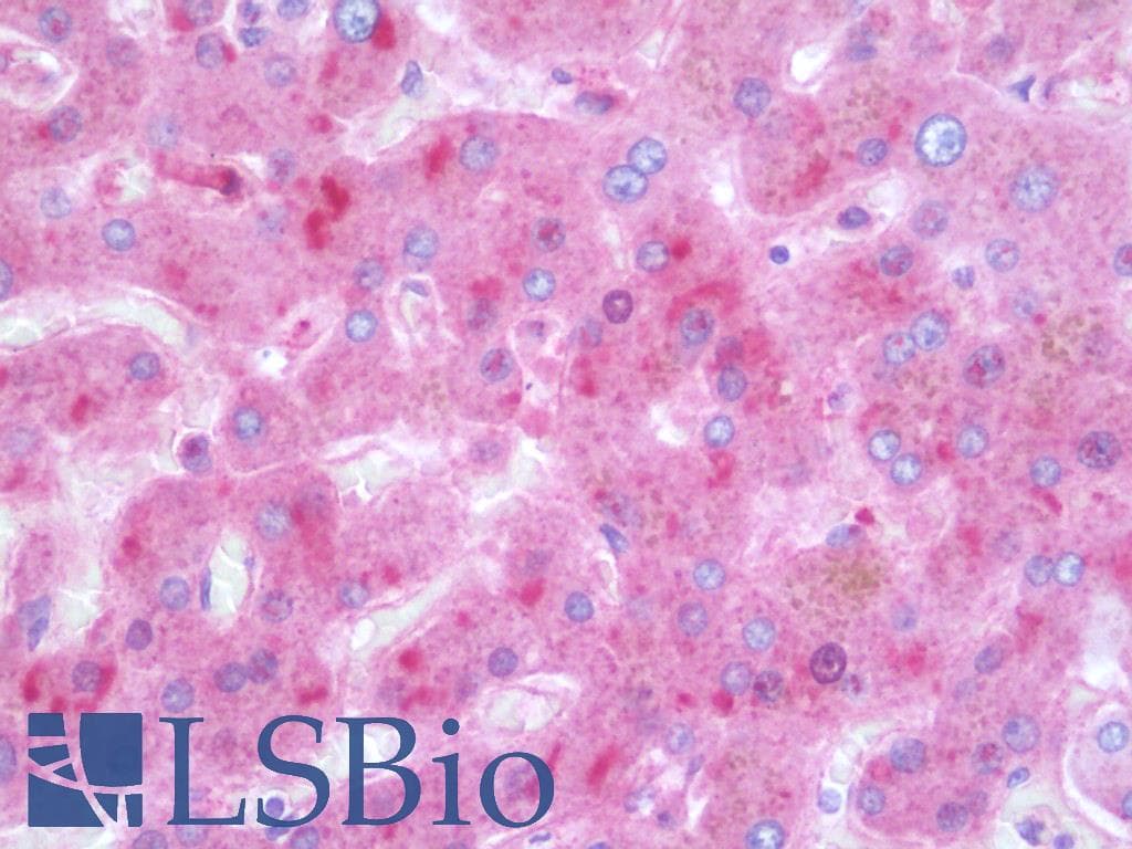 IHC-plus™ SERPINA1 / Alpha 1 Antitrypsin Antibody (clone 15H10)