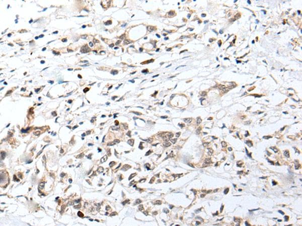 Polyclonal Rabbit anti-Human CHRNA5 Antibody (IHC)