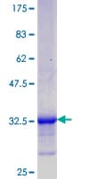 Human C5orf13 Protein (Recombinant GST, N-terminus)
