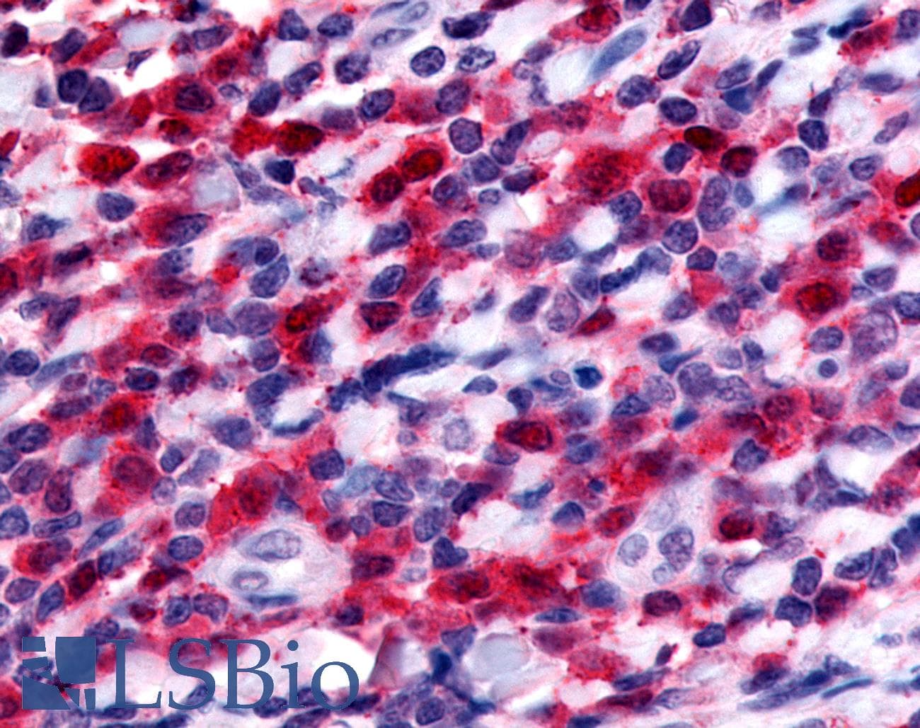 IHC-plus™ Polyclonal Rabbit anti-Human CD135 / FLT3 Antibody (Internal, IHC)