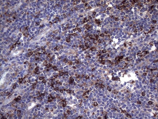 CD68 Antibody (clone KP1)