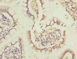 HUM2DD / DHDH Antibody
